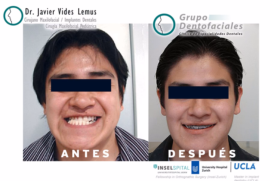 ¿Cuánto gana un maxilofacial en Estados Unidos?
