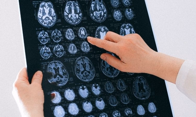 ¿Dónde trabajar siendo neuropsicólogo?